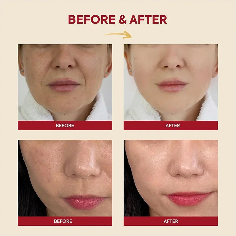 Seoul 1988- Korean Skin Care Set