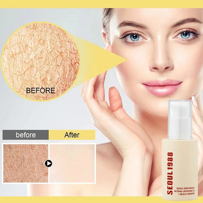 Seoul 1988- Korean Skin Care Set