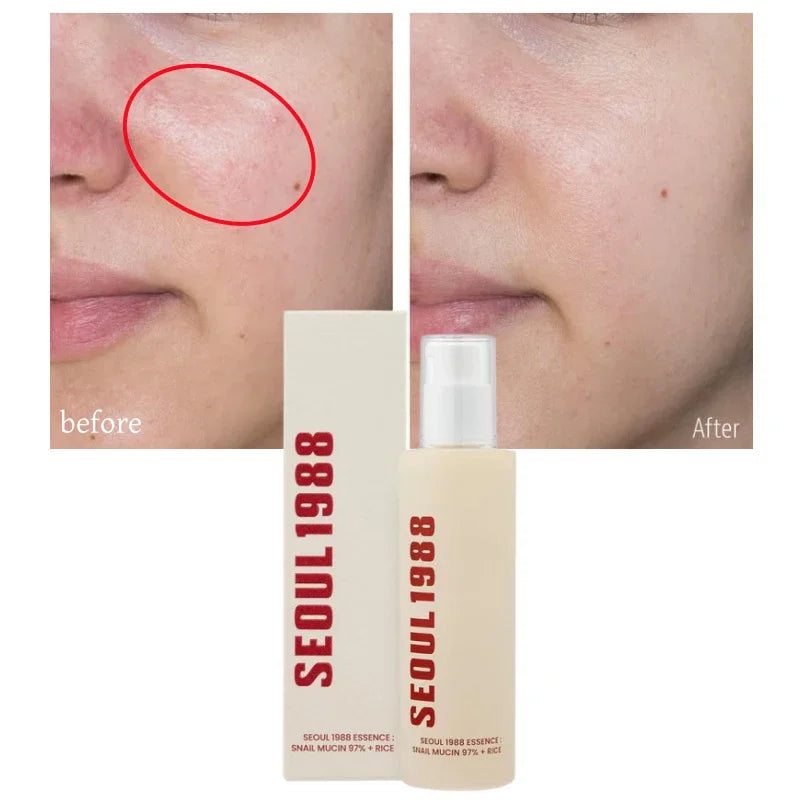 Seoul 1988- Korean Skin Care Set