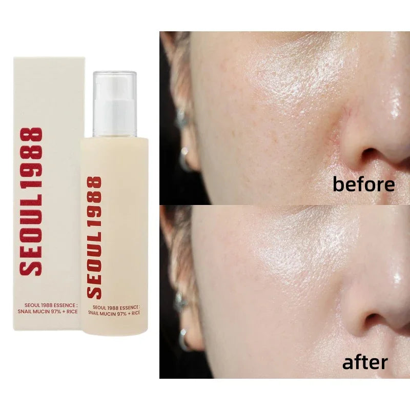 Seoul 1988- Korean Skin Care Set
