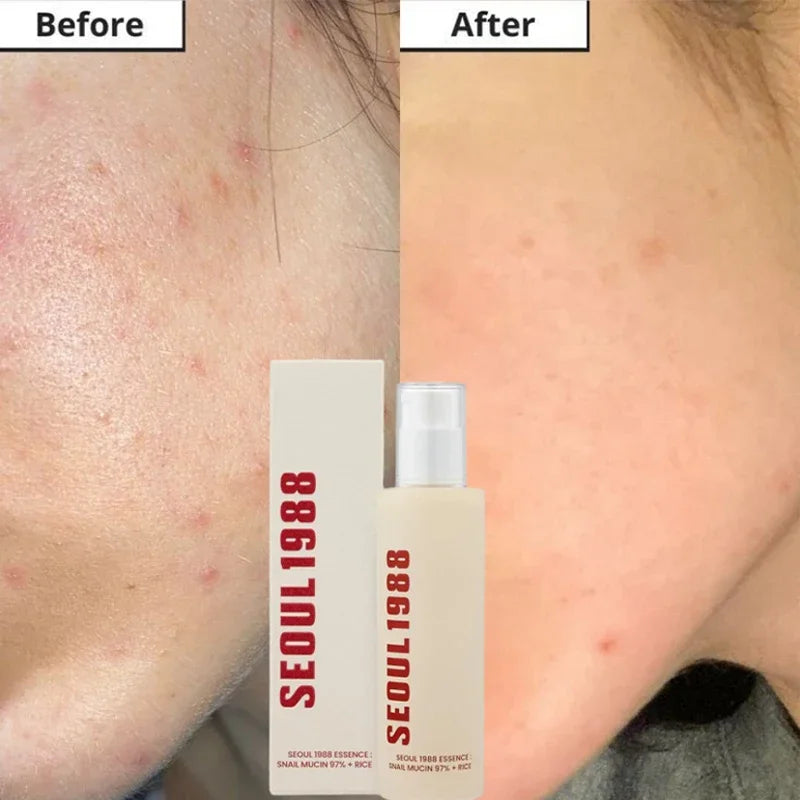 Seoul 1988- Korean Skin Care Set