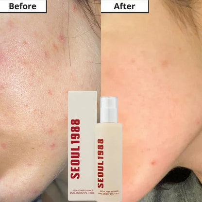 Seoul 1988- Korean Skin Care Set